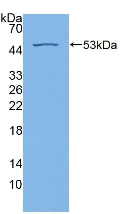 Western blot - Anti-RS1 antibody (AB233428)