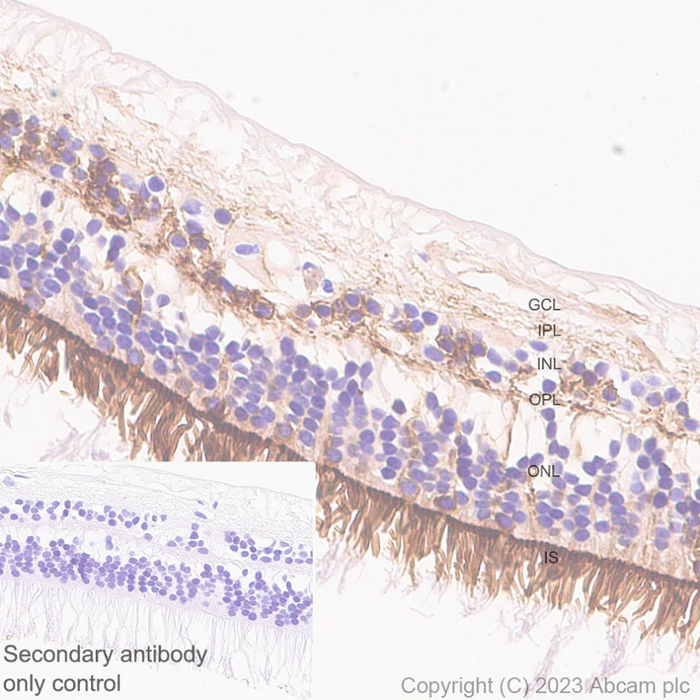 Immunohistochemistry (Formalin/PFA-fixed paraffin-embedded sections) - Anti-RS1 antibody [EPR28513-78] (AB314231)