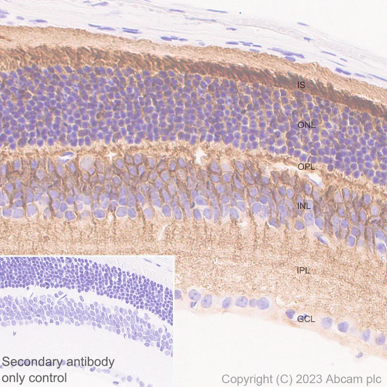 Immunohistochemistry (Formalin/PFA-fixed paraffin-embedded sections) - Anti-RS1 antibody [EPR28513-78] (AB314231)