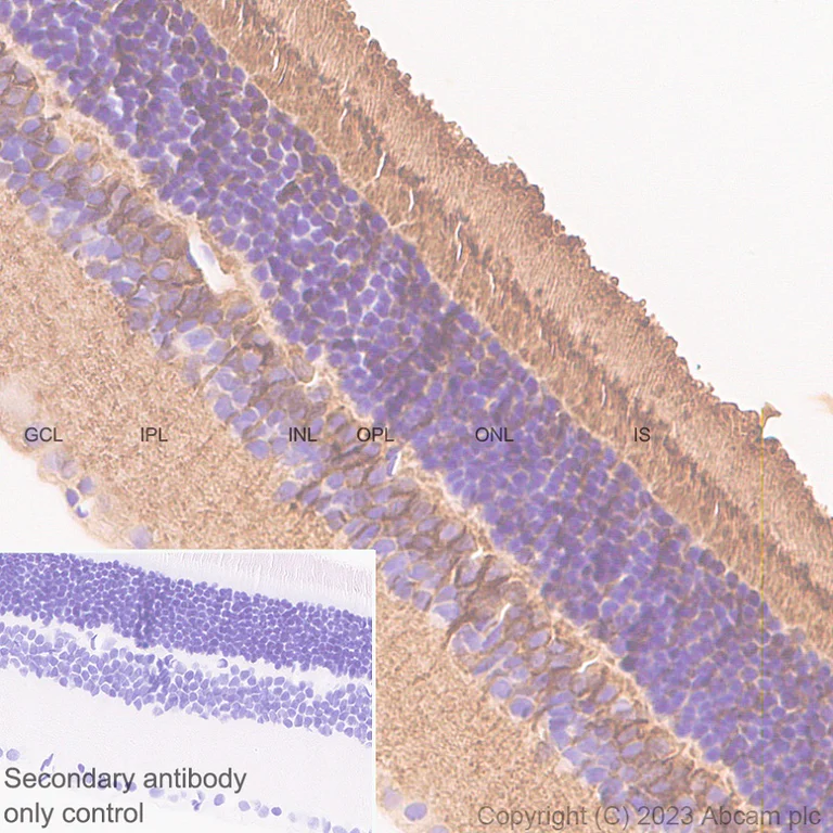 Immunohistochemistry (Formalin/PFA-fixed paraffin-embedded sections) - Anti-RS1 antibody [EPR28513-78] (AB314231)