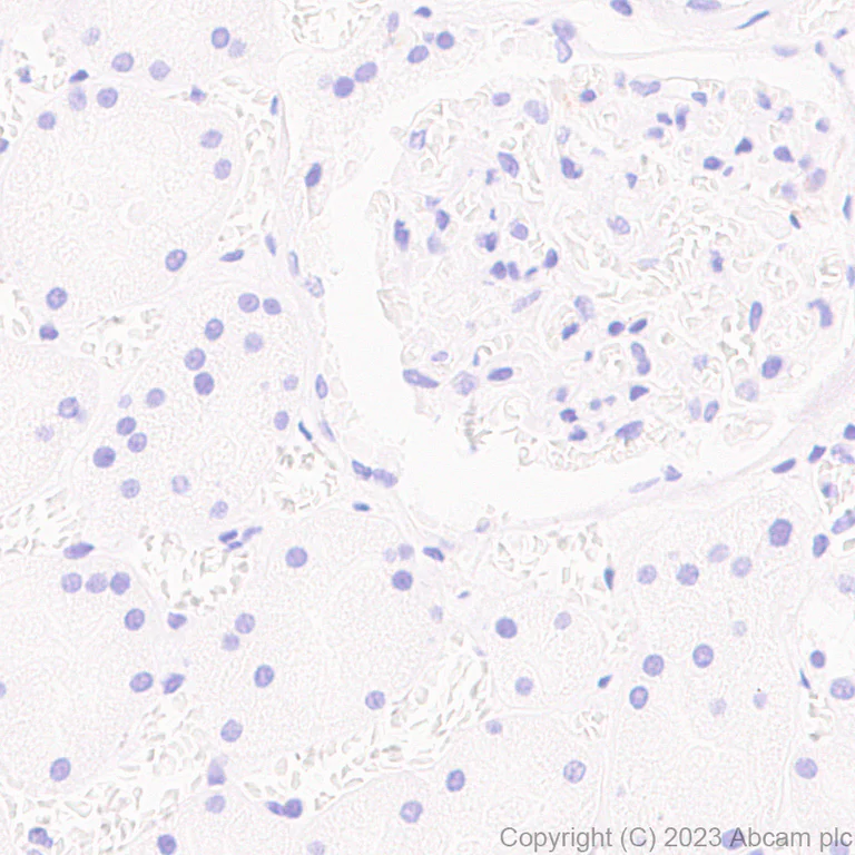 Immunohistochemistry (Formalin/PFA-fixed paraffin-embedded sections) - Anti-RS1 antibody [EPR28513-78] (AB314231)