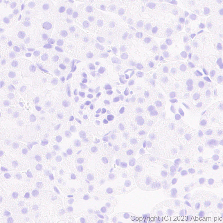 Immunohistochemistry (Formalin/PFA-fixed paraffin-embedded sections) - Anti-RS1 antibody [EPR28513-78] (AB314231)