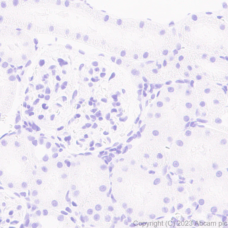 Immunohistochemistry (Formalin/PFA-fixed paraffin-embedded sections) - Anti-RS1 antibody [EPR28513-78] (AB314231)