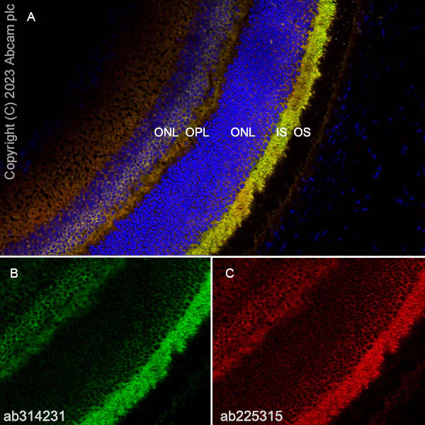 Immunohistochemistry (Frozen sections) - Anti-RS1 antibody [EPR28513-78] (AB314231)