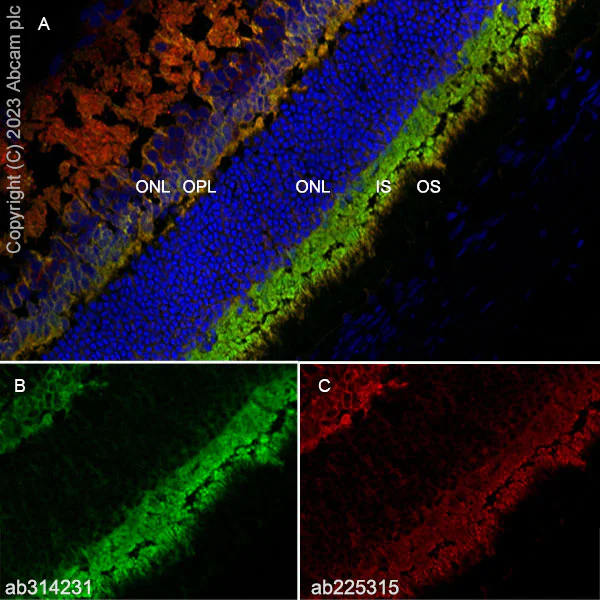Immunohistochemistry (Frozen sections) - Anti-RS1 antibody [EPR28513-78] (AB314231)