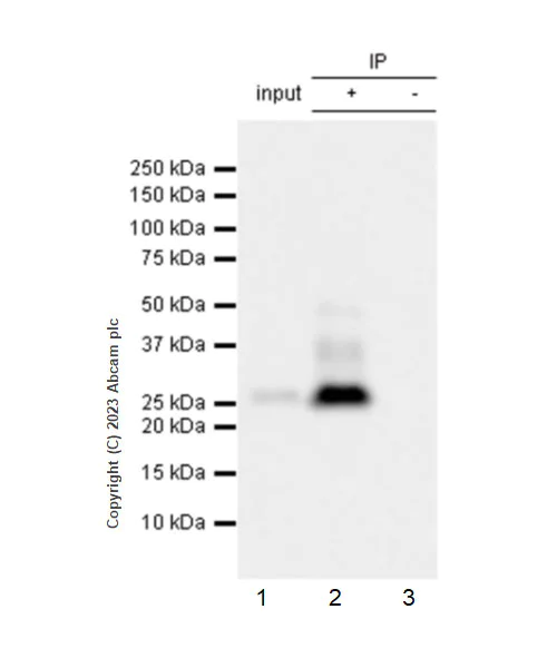 Immunoprecipitation - Anti-RS1 antibody [EPR28513-78] (AB314231)