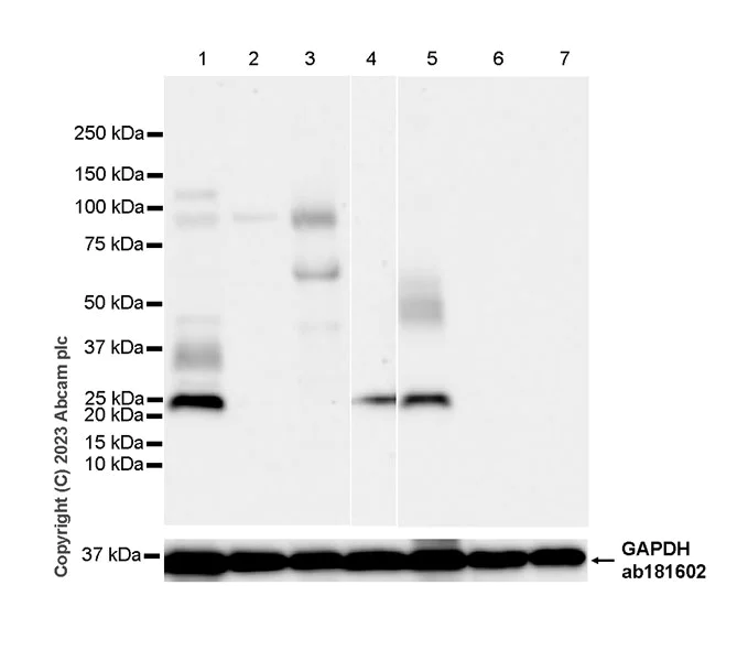 Western blot - Anti-RS1 antibody [EPR28513-78] (AB314231)