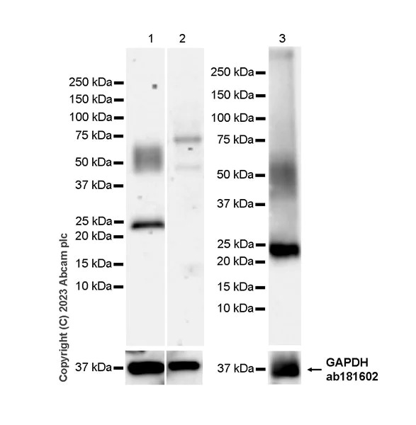 Western blot - Anti-RS1 antibody [EPR28513-78] (AB314231)