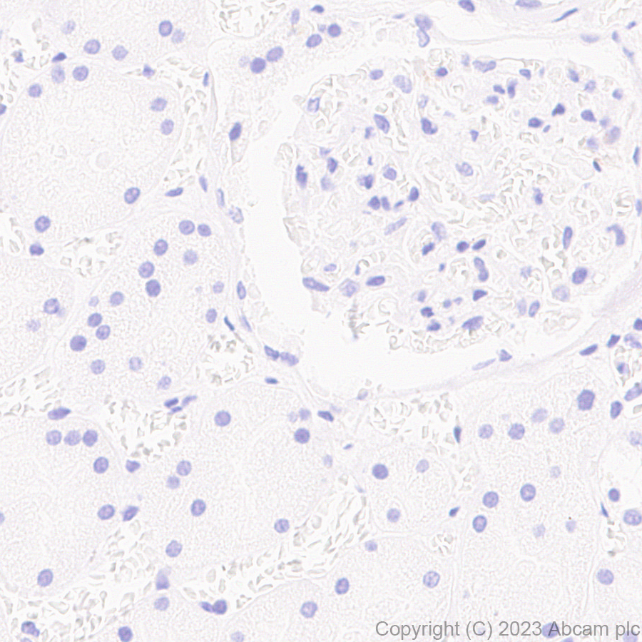 Immunohistochemistry (Formalin/PFA-fixed paraffin-embedded sections) - Anti-RS1 antibody [EPR28513-78] - BSA and Azide free (AB314232)