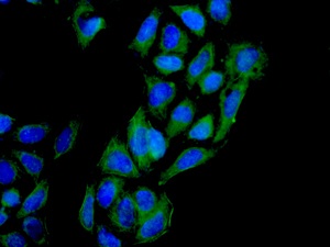 Immunocytochemistry/ Immunofluorescence - Anti-rSec6 antibody [EPR10812] (AB156568)