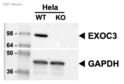 Western blot - Anti-rSec6 antibody [EPR10812] (AB156568)