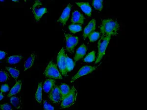 Immunocytochemistry/ Immunofluorescence - Anti-rSec6 antibody [EPR10812] - BSA and Azide free (AB249263)