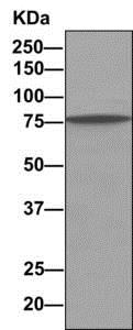 Immunoprecipitation - Anti-rSec6 antibody [EPR10812] - BSA and Azide free (AB249263), expandable thumbnail