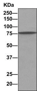 Immunoprecipitation - Anti-rSec6 antibody [EPR10812] - BSA and Azide free (AB249263)