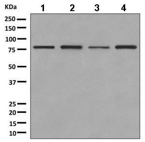 Western blot - Anti-rSec6 antibody [EPR10812] - BSA and Azide free (AB249263), expandable thumbnail