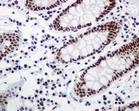 Immunohistochemistry (Formalin/PFA-fixed paraffin-embedded sections) - Anti-RSF1 antibody [EPR3749(2)] (AB109002)