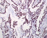 Immunohistochemistry (Formalin/PFA-fixed paraffin-embedded sections) - Anti-RSF1 antibody [EPR3749(2)] - BSA and Azide free (AB232564)