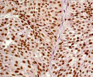 Immunohistochemistry (Formalin/PFA-fixed paraffin-embedded sections) - Anti-Rsk 2 / MAPKAP Kinase 1b antibody [Y82] (AB32062)