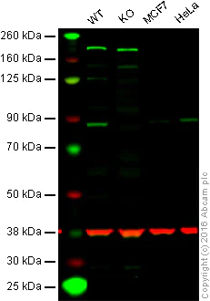 Western blot - Anti-Rsk 2 / MAPKAP Kinase 1b antibody [Y82] (AB32062)
