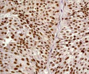 Immunohistochemistry (Formalin/PFA-fixed paraffin-embedded sections) - Anti-Rsk 2 / MAPKAP Kinase 1b antibody [Y82] - BSA and Azide free (AB247218)