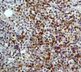 Immunohistochemistry (Formalin/PFA-fixed paraffin-embedded sections) - Anti-Rsk 2 / MAPKAP Kinase 1b antibody [Y83] (AB32133)