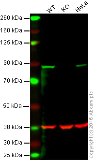Western blot - Anti-Rsk 2 / MAPKAP Kinase 1b antibody [Y83] (AB32133)