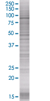 Rsk 2 / MAPKAP Kinase 1b overexpression 293T lysate (whole cell)