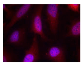 Immunocytochemistry/ Immunofluorescence - Anti-RSK1 p90 antibody (AB131445)