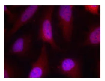 Immunocytochemistry/ Immunofluorescence - Anti-RSK1 p90 antibody (AB131445)