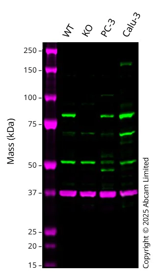 Western blot - Anti-RSK1 p90 antibody [E4] (AB32114)