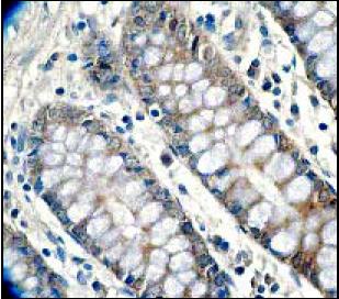 Immunohistochemistry (Formalin/PFA-fixed paraffin-embedded sections) - Anti-RSK1 p90 antibody [E4] - BSA and Azide free (AB239805), expandable thumbnail