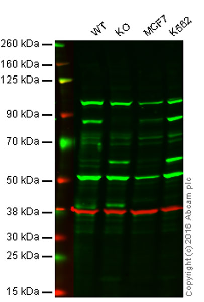 Western blot - Anti-RSK1 p90 antibody [Y81] (AB32526), expandable thumbnail