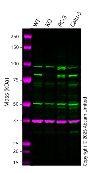 Western blot - Anti-RSK1 p90 antibody [Y81] (AB32526)