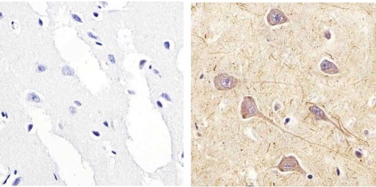 Immunohistochemistry (Formalin/PFA-fixed paraffin-embedded sections) - Anti-RSK1 p90 (phospho S221) antibody (AB10695)