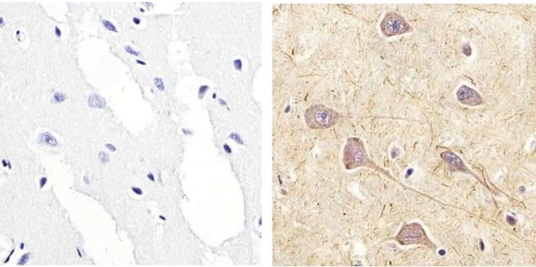 Immunohistochemistry (Formalin/PFA-fixed paraffin-embedded sections) - Anti-RSK1 p90 (phospho S221) antibody (AB10695)