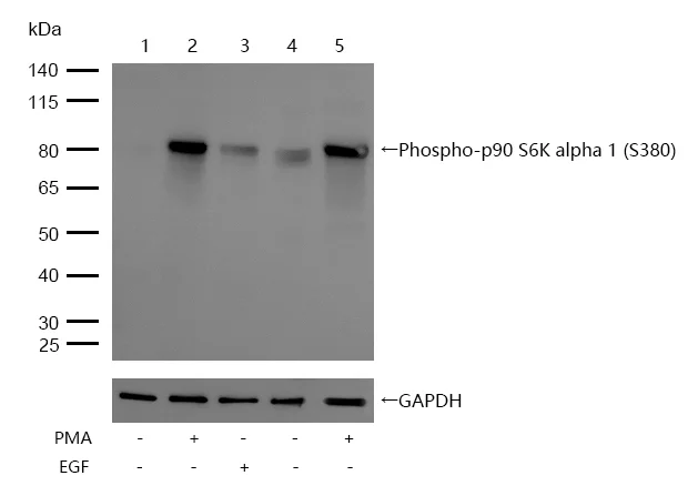 Western blot - Anti-RSK1 p90 (phospho S308) antibody [SR2279] (AB326649)