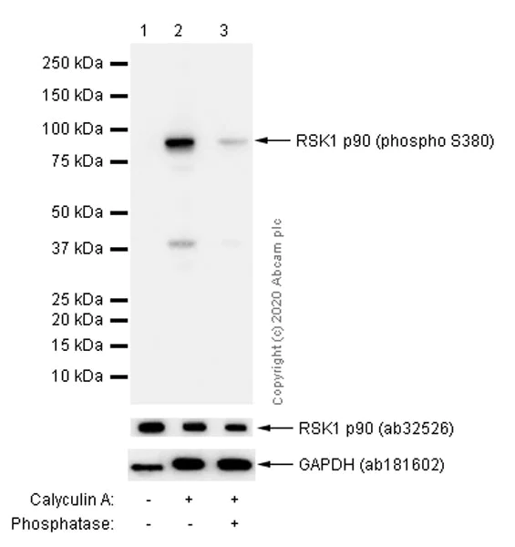 Western blot - Anti-RSK1 p90 (phospho S380) antibody [E239] (AB32203)