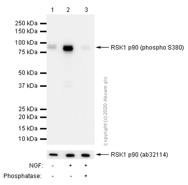 Western blot - Anti-RSK1 p90 (phospho S380) antibody [E239] - BSA and Azide free (AB247241)