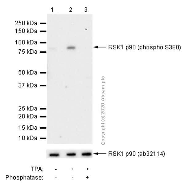 Western blot - Anti-RSK1 p90 (phospho S380) antibody [E239] - BSA and Azide free (AB247241), expandable thumbnail