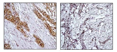 Immunohistochemistry (Formalin/PFA-fixed paraffin-embedded sections) - Anti-RSK1 p90 (phospho T359) antibody [E238] (AB32413), expandable thumbnail