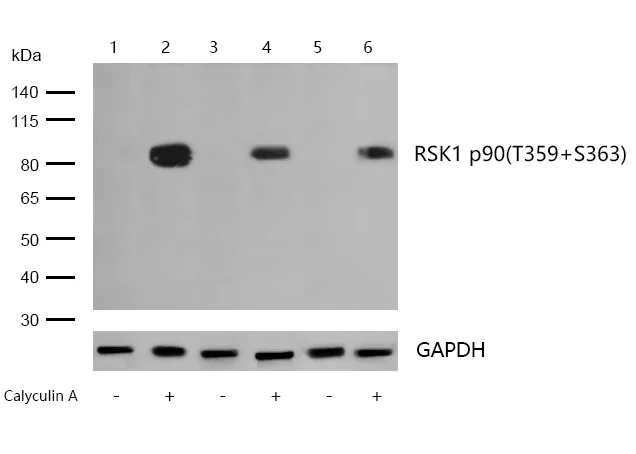 Western blot - Anti-RSK1 p90 (phospho T359 + S363)antibody [SU03-65] (AB326620)