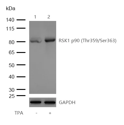 Western blot - Anti-RSK1 p90 (phospho T359 + S363)antibody [SU03-65] (AB326620)