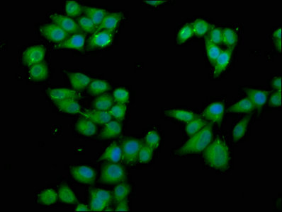 Immunocytochemistry/ Immunofluorescence - Anti-RSK3 antibody (AB238332), expandable thumbnail