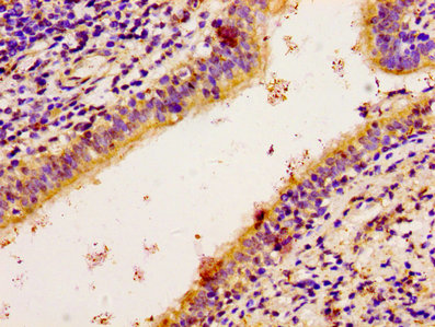 Immunohistochemistry (Formalin/PFA-fixed paraffin-embedded sections) - Anti-RSK3 antibody (AB238332), expandable thumbnail