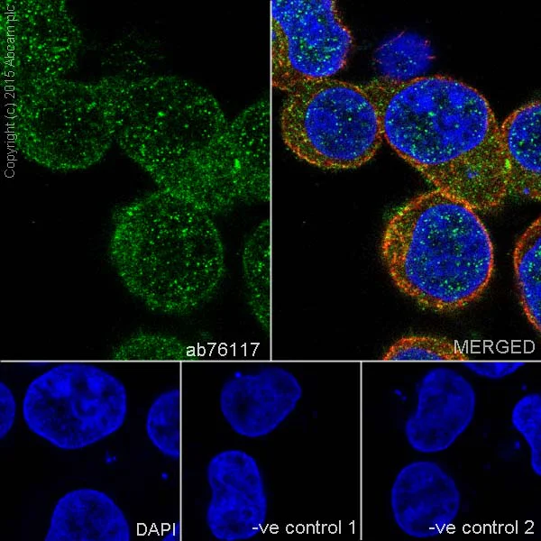 Immunocytochemistry/ Immunofluorescence - Anti-RSK4 antibody [EP1982Y] (AB76117)