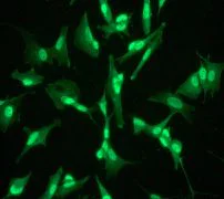 Immunocytochemistry/ Immunofluorescence - Anti-RSK4 antibody [EP1982Y] (AB76117)