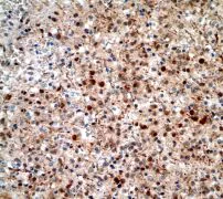 Immunohistochemistry (Formalin/PFA-fixed paraffin-embedded sections) - Anti-RSK4 antibody [EP1982Y] (AB76117)