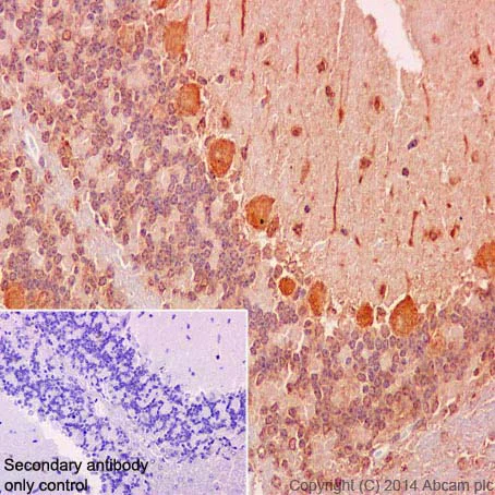 Immunohistochemistry (Formalin/PFA-fixed paraffin-embedded sections) - Anti-RSK4 antibody [EP1982Y] (AB76117)