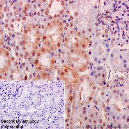 Immunohistochemistry (Formalin/PFA-fixed paraffin-embedded sections) - Anti-RSK4 antibody [EP1982Y] (AB76117)