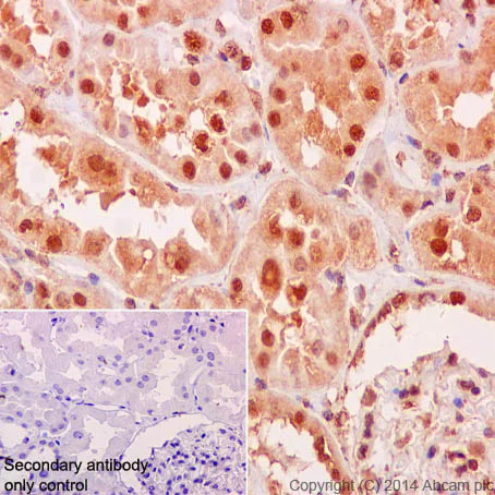Immunohistochemistry (Formalin/PFA-fixed paraffin-embedded sections) - Anti-RSK4 antibody [EP1982Y] (AB76117)